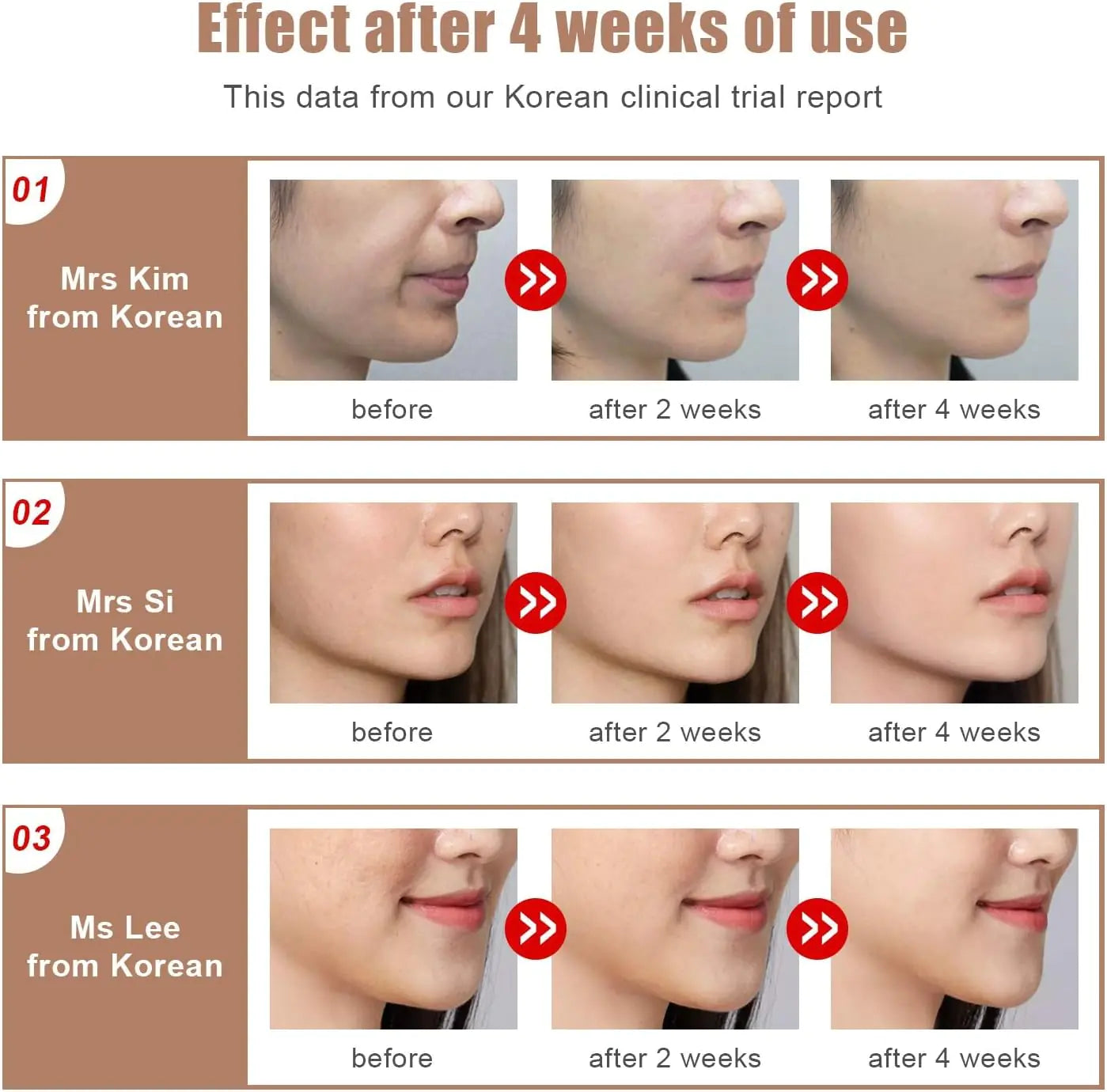 JawlineLift Sculpting Device - 2026 Edition